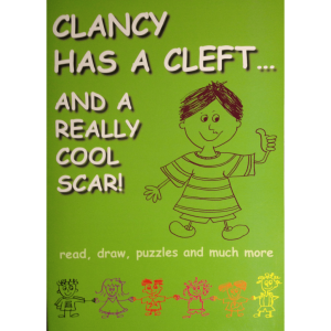 Clancy has a cleft…and a really cool scar